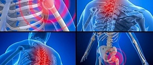 Хроническая боль. Нейронный механизм